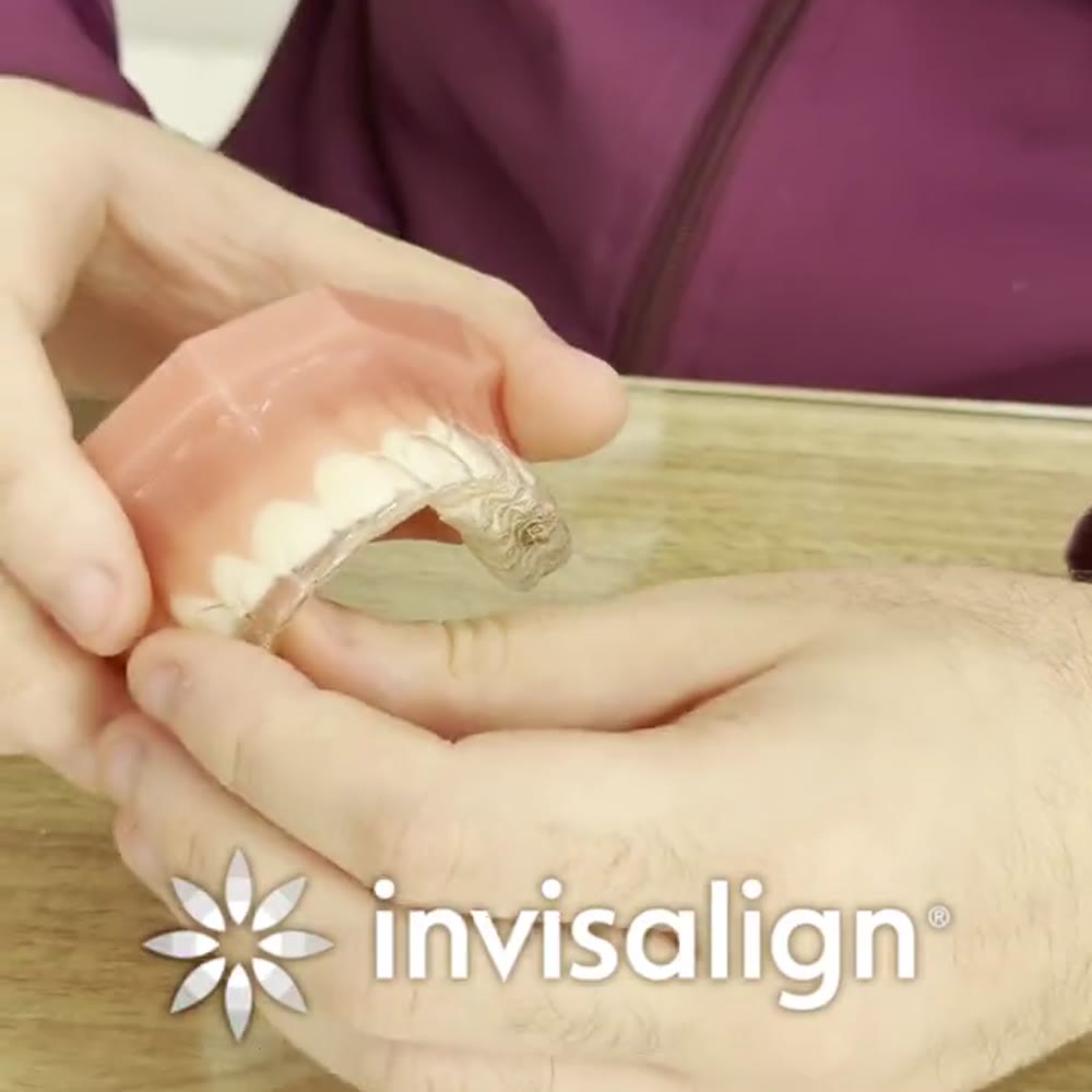 Alinhador transparente Invisalign — Oral Unic Viamão